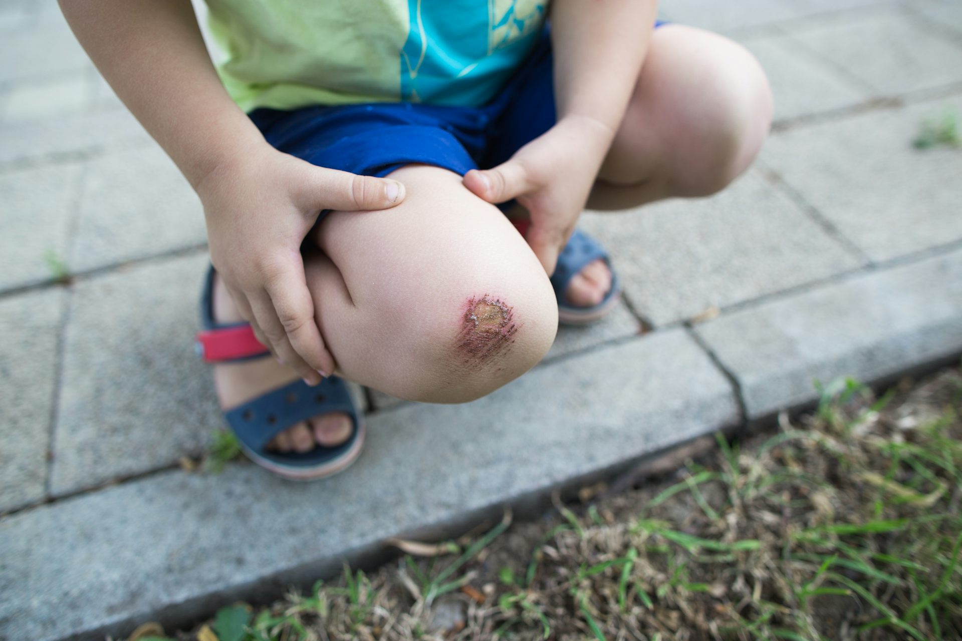 Close-up of a child's scraped knee with hands holding it, standing on a sidewalk near grass, neutral colors, mood of minor injury and care.